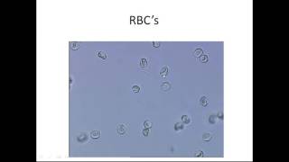 Microscopic Urinalysis [upl. by Rolo]