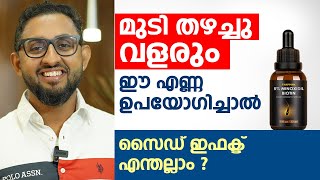 മുടി തഴച്ചു വളരും ഈ എണ്ണ ഉപയോഗിച്ചാൽ മതി  Minoxidil Side Effects  Dr varun Nambiar [upl. by Akemor203]