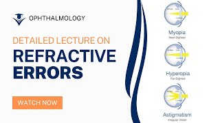 Understanding Refractive Errors in Ophthalmology A Comprehensive Lecture [upl. by Neelyt]