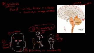 Migraine pathophysiology [upl. by Annaor160]