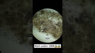 quotDog saliva magnified 400X is so coolquotunderthemicroscope [upl. by Willing]