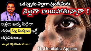 నల్ల మచ్చలు పోవడానికి ఇలా చెయ్యండిhow to get rid of hyperpigmentationblack skinblack pigmentation [upl. by Brose887]