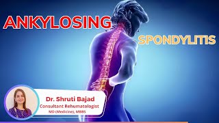 Ankylosing Spondylitis arthritis spine jointpain inflammatory disease flexibility jointpain [upl. by Esaj392]