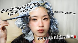 BLEACHING MY HAIR AT HOME WENT HORRIBLY WRONGbleach burnblood scabs and healing [upl. by Acul]