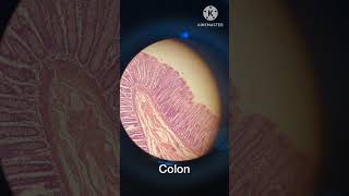 Small intestine Colon Histology mbbs shorts trending [upl. by Hselin304]