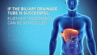 Biliary Drain [upl. by Aratihc658]