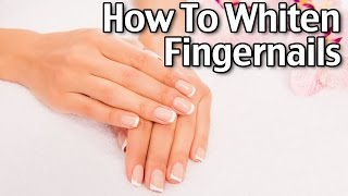 How To Whiten Fingernails [upl. by Ahsiaa]