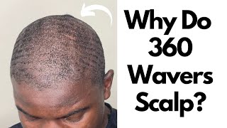 Why Do 360 Wavers Scalp Bald How To Get 360 Waves [upl. by Becca117]