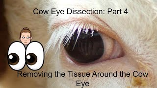 Cow Eye Dissection Part 4 Removing the Tissue Around the Cow Eye anatomy and physiology lesson [upl. by Eicnahc417]