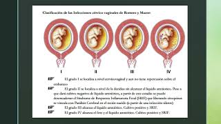 Prevención de infecciones neonatales durante el embarazo [upl. by Fitts782]