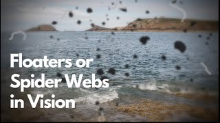 Seeing Floaters or Spider Webs in Vision  EXPLAINED  Dr DOrio Eyecare [upl. by Cathi910]