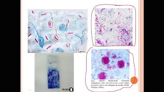 Coloração aula 2 Ziehl Neelsen e Gram para fungos [upl. by Grogan84]