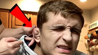 Draining A Cauliflower Ear [upl. by Poyssick]