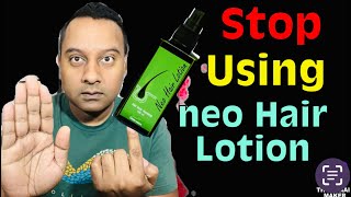 When to stop using Neo Hair Lotion Completely [upl. by Fronnia403]