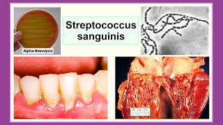 Streptococcus sanguinis [upl. by Nagirrek544]