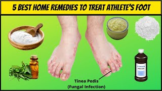 5 Best Natural Home Remedies For Athletes Foot  How To Get Rid of Athletes Foot Home Remedies [upl. by Wordoow72]