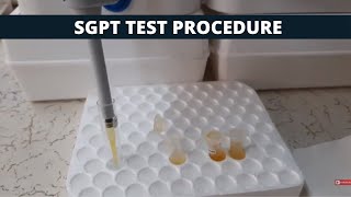 SGPT Test Procedure  SGPT Simple Test Procedure [upl. by Victoria]