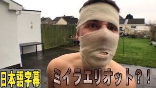 Ben Phillips 42 日サロしたら皮剥けまくるドッキリw【日本語字幕付き】 [upl. by Nirrat]