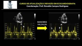 DIRETRIZ ASEEACI 2016  ESTUDO DA FUNÇÃO DIASTÓLICA DO VENTRÍCULO ESQUERDO [upl. by Mclaurin]