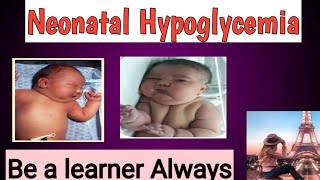 Neonatal Hypoglycemia [upl. by Elleirol601]