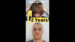 💇🏻💈Hair Growth Time Lapse 24 Months 2 Years Men  From Buzz Cut [upl. by Snevets]