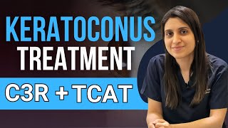 Treatment Of Keratoconus C3R TCAT C3R [upl. by Wendell]