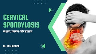 Cervical Spondylosis Treatment Causes Symptoms and Exercises  Cervical Spondylosis का सटीक इलाज [upl. by Trinity662]