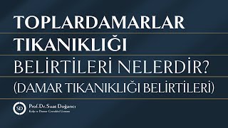 Toplardamarlar Tıkanıklığı Belirtileri Nelerdir Damar Tıkanıklığı Belirtileri [upl. by Eidur]