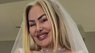 Darcey Silvas unfiltered wedding pictures are scaring her fans [upl. by Fruma80]