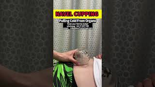 Experience Navel Cupping Therapy An Ancient Technique for Modern Wellness [upl. by Hasheem797]