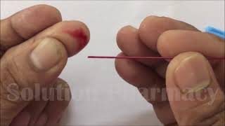 Blood Clotting Time Determination by Using Capillary Method  Blood Clotting Time Test  ENGLISH [upl. by Kimber]