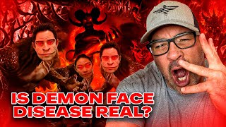 REAL Demon Face Syndrome RevealedShapeshifters Among Us You Will Not Believe This [upl. by Lotson822]