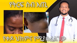 የትርፍ ስብ እጢ የቀዶ ህክምና Lipoma Surgery  ዶር ዮናታን ከተማ  Dr YonathanK  kedmia letenawo [upl. by Aimaj320]