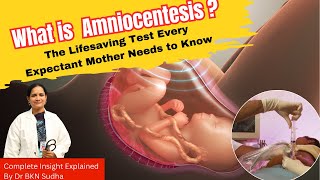 Amniocentesis Unveiled The Lifesaving Test Every Expectant Mother Needs to Know  Dr BKN Sudha [upl. by Querida]