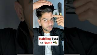 Hairline test in just 1 min 😲✨📸 shorts hairline hair hairproblems hairstyle haircare [upl. by Dore]