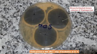 Cladosporium and Penicillium Colony Morphology on SDA and LPCB Preparation [upl. by Regnij]