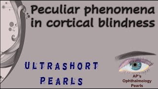 Peculiar Phenomena in Cortical Blindness  Riddoch Phenomenon  Blindsight  Anton Syndrome [upl. by Pascia]