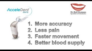 Dr Rafi Romano accelerate teeth movement with AcceleDent [upl. by Imij]