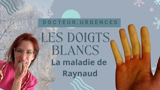 Le syndrome des doigts blancs Raynaud [upl. by Emelia951]