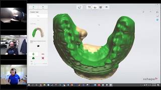 Digital Dentistry Training Series Scan and Design Digital Temporaries [upl. by Misa349]