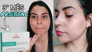 RESENHA PROBIAC EXIMIA 3° MÊS  ACNE HORMONAL  CRIS MARIA [upl. by Natye760]