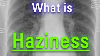 How to Say Haziness in English  How Does Haziness Look  What is Haziness [upl. by Ivie]