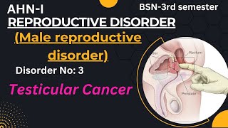 TesticularProstrate cancer in Urdu Hindi BSN3Semester AHNI Male reproductive disorder [upl. by Ajani]