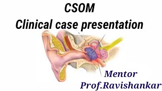 CSOM Clinical case presentation [upl. by Jar]