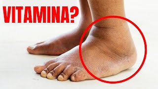 La VITAMINA NUMERO 1 per eliminare la cattiva CIRCOLAZIONE di gambe e piedi [upl. by Kcirdle]