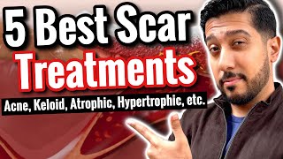 5 BEST Products for Scars  How to Get RID of Scars All Types [upl. by Longo]