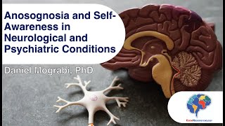 Anosognosia and SelfAwareness in Neurological and Psychiatric Conditions [upl. by Tyika]