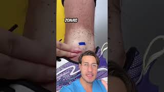 Solo lávate Dermatosis Neglecta shorts shortvideo dermatologia skincare [upl. by Ramedlav]