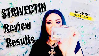 STRIVECTIN NECK CREAM REVIEW FINAL RESULTS [upl. by Evelunn]