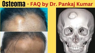 Osteoma  Common Questions and answers Scarless Osteoma Removal surgery How to remove osteoma [upl. by Fabiano171]